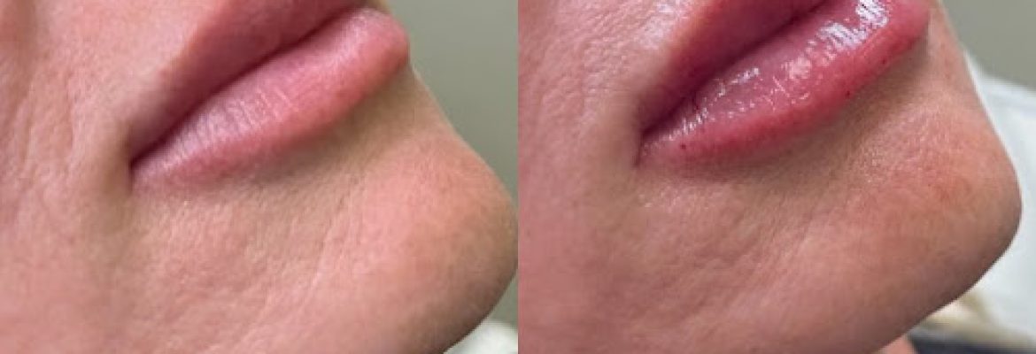 The Beauty Spot MedSpa