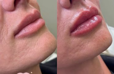 The Beauty Spot MedSpa
