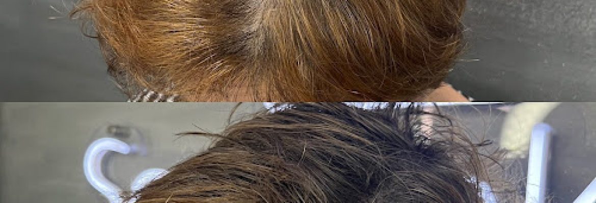 Scalp Ink Connecticut
