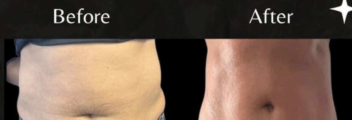 Body Contour & Spa