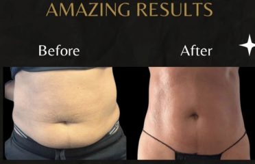 Body Contour & Spa