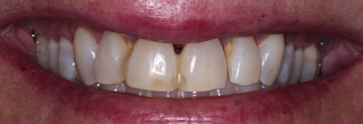 East Haven Dentistry