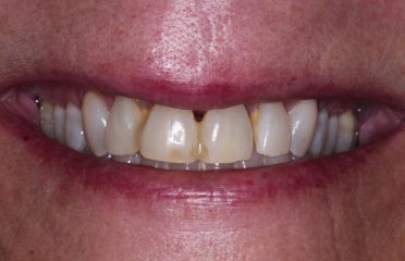 East Haven Dentistry