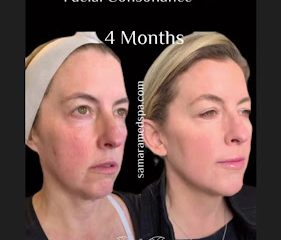 Samara MedSpa Glastonbury
