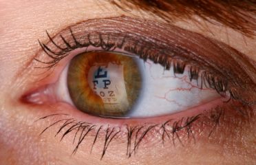 Connecticut Eye Care Center: Patrick Albergo MD, Duane Austin MD