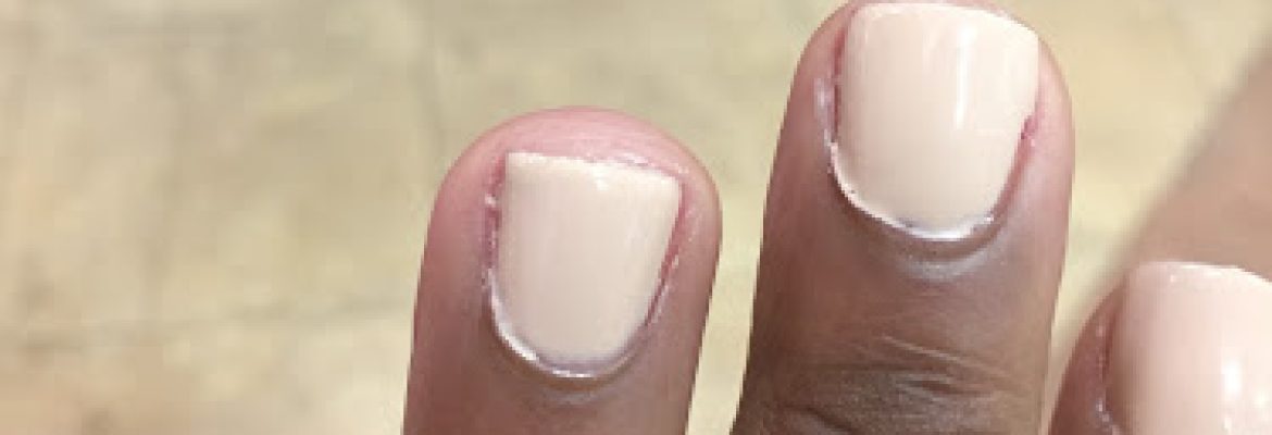 Nail Fever