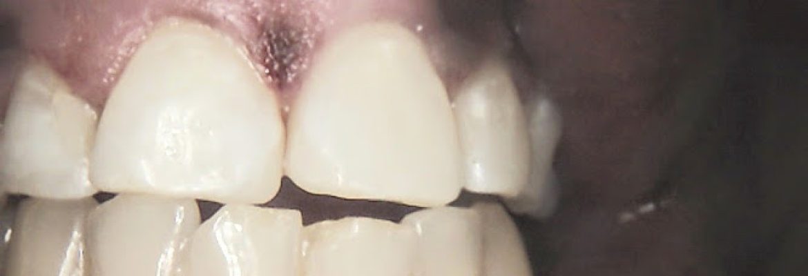 Family Dental Center Of Connecticut
