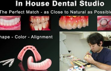In-House Dental Studio