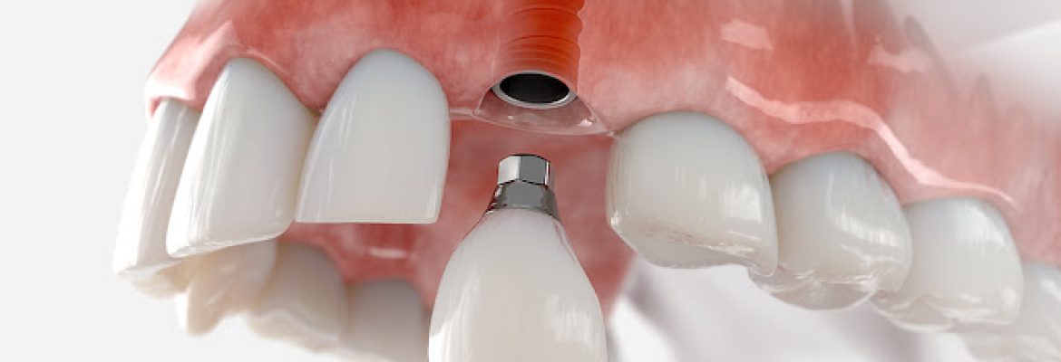 AN Family Dentistry – Alireza Namjoo DDS and Jennifer Arscott DDS