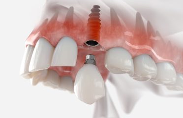 AN Family Dentistry – Alireza Namjoo DDS and Jennifer Arscott DDS